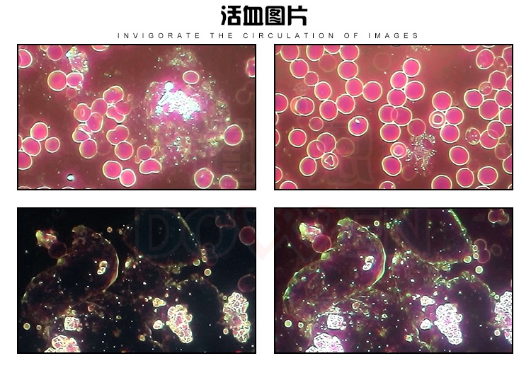 黑背景一滴血检测仪（高清款）活血图