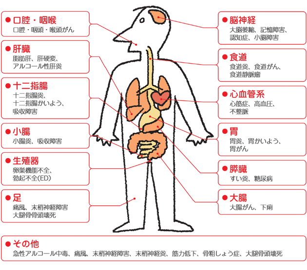 消化器の病気：イラスト