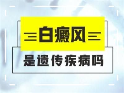 白癜风复发的原因有哪些?