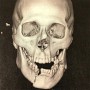 【RIZIN19】佐々木憂流迦が公開した顎粉砕写真に衝撃の声｢朝倉海のパンチ力エグいｗ｣｢殺人パンチ｣