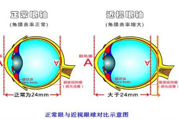 世博视视力矫正中心加盟