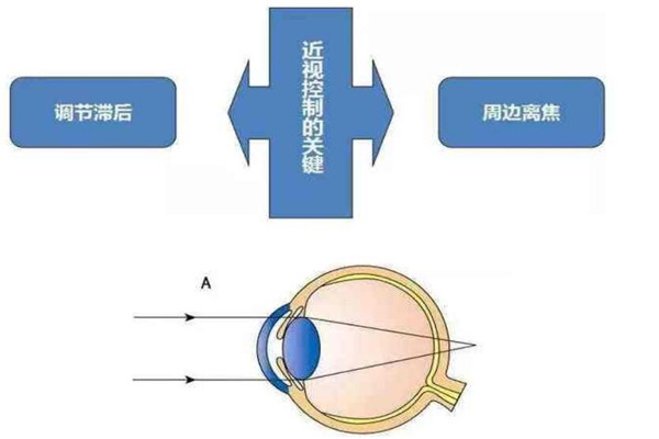 明普慧视视力保健眼眶