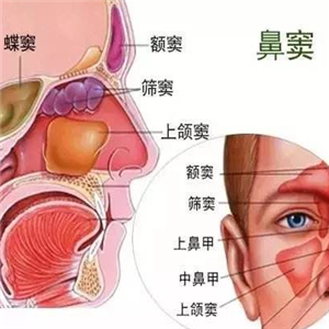 和济堂苓芷鼻炎膏鼻窦炎