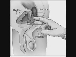 How To Milk Your Prostate By Yourself