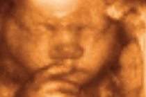 : baby-ultrasound.com