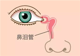 一岁宝宝眼屎突然变多是怎么回事怎么办 宝宝眼屎多按摩鼻泪管怎么做