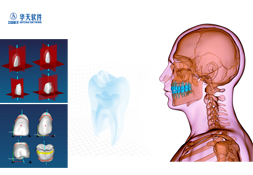 全口義齒多源數據融合及CAD/RP 系統趕超國際數字化口腔診療先進技術