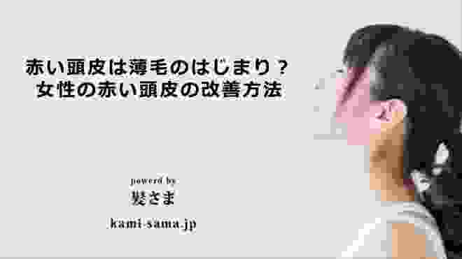 女性育毛剤の使い方／赤い頭皮は薄毛のはじまり？女性の赤い頭皮の改善方法