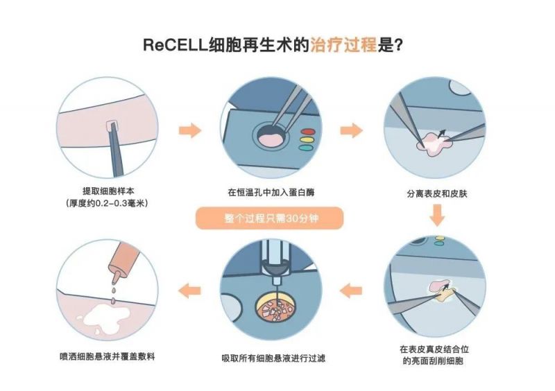 白癜风医院盐城哪家好排名榜公布，白斑又扩散了，夏季这些治疗优势你知道吗？还不快来强化治疗！